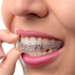 invisalign-the-best-option-for-adults